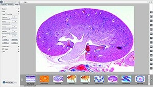 Caméra digitale couleur CMEX Pro 5 mp, USB-3, Image focus