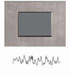 Reference specimens random Ra = 0.1 µm, nickel-boron