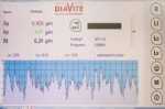 Software DIAVITE APP REGULAR «optie golving»